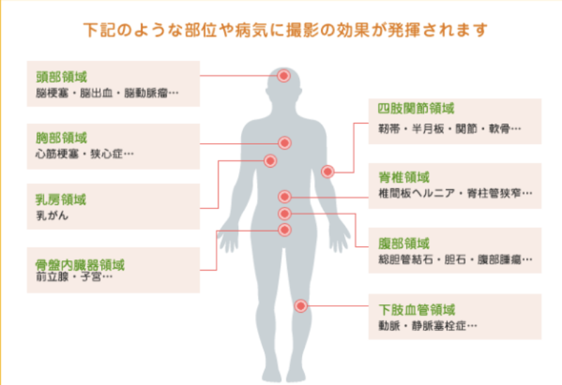 >MRI適応疾患・部位